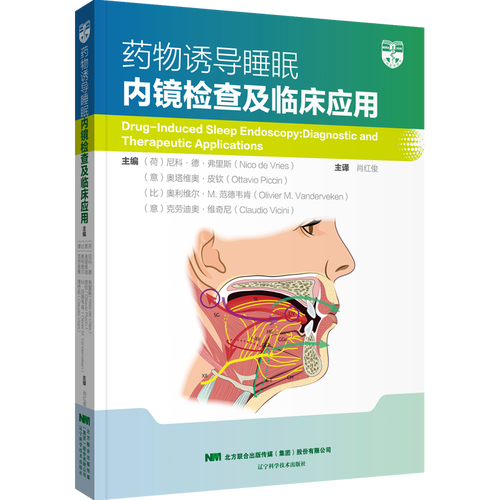 药物诱导睡眠 内镜检查及临床应用